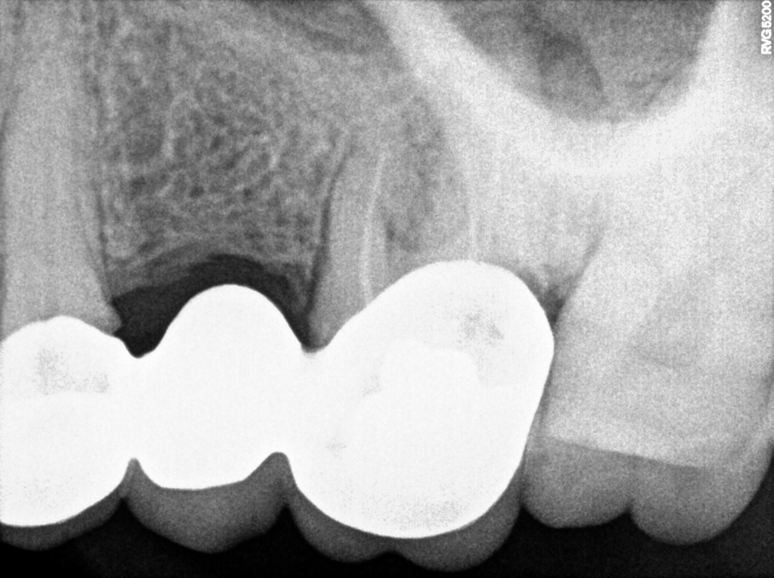 Dental X-ray